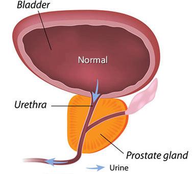 Normal Prostate Gland