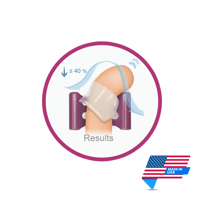 Andropeyronie Penile Traction Device Mens Health Downunder